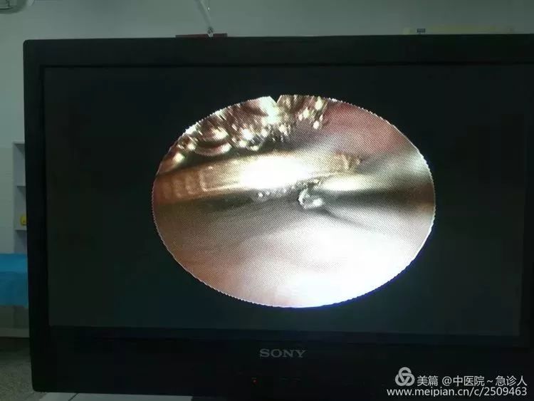 三分钟了解&quot;CT看穿仪怎样看穿硬币的正反面—详细解说+新浪科技